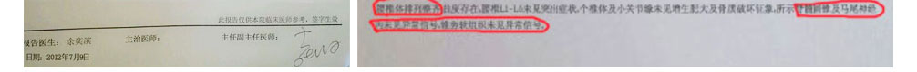 龙布峰针贴正品官网